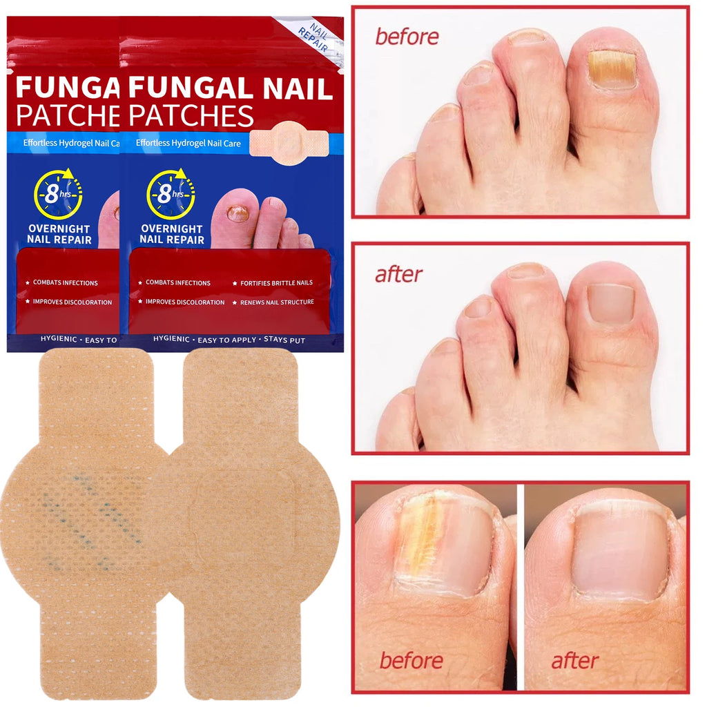 21/210pcs Waterproof Nail Protector Guard, Breathable Finger Sleeve for Weak or Damaged Nails, Reusable Toe Cap Cover