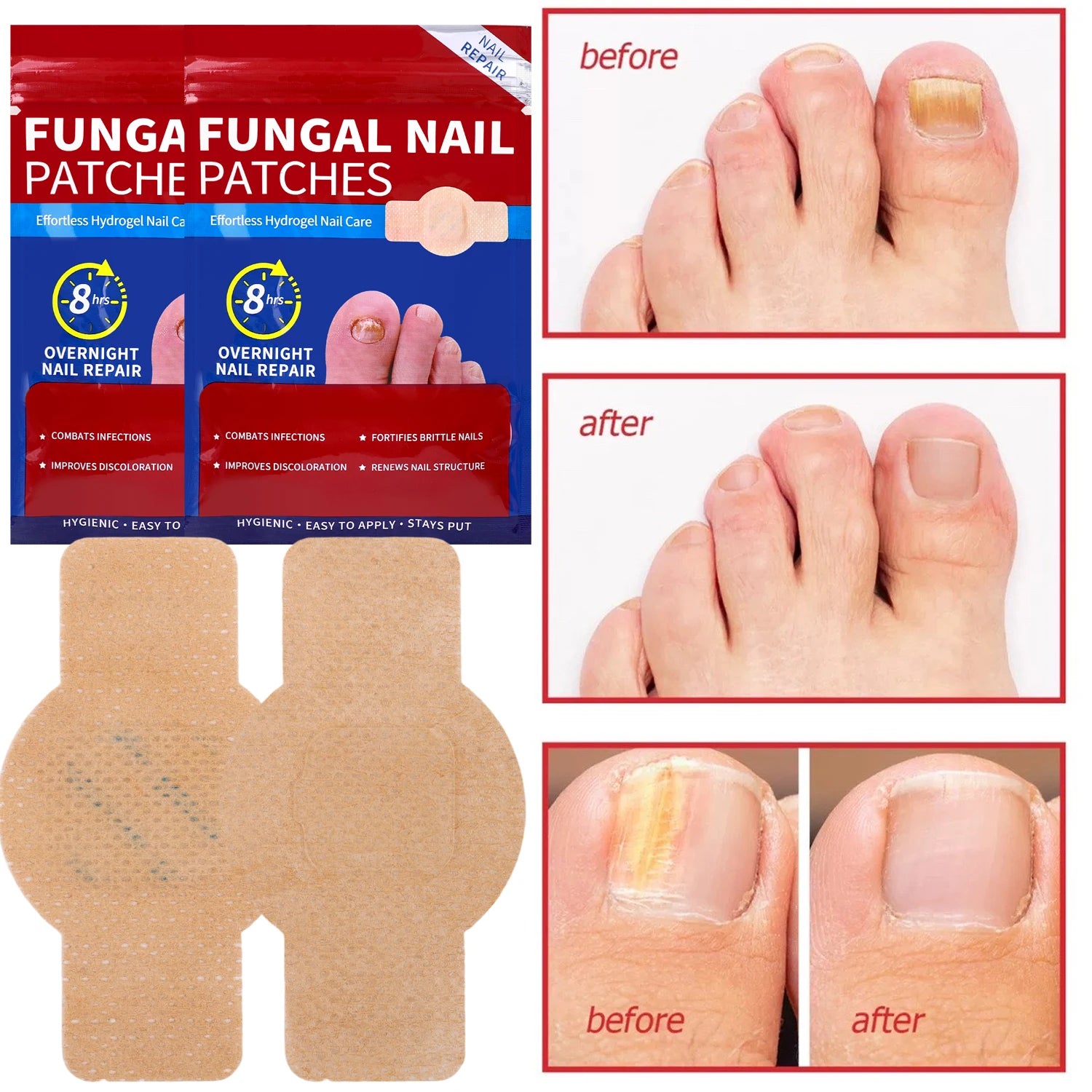 21/210pcs Waterproof Nail Protector Guard, Breathable Finger Sleeve for Weak or Damaged Nails, Reusable Toe Cap Cover