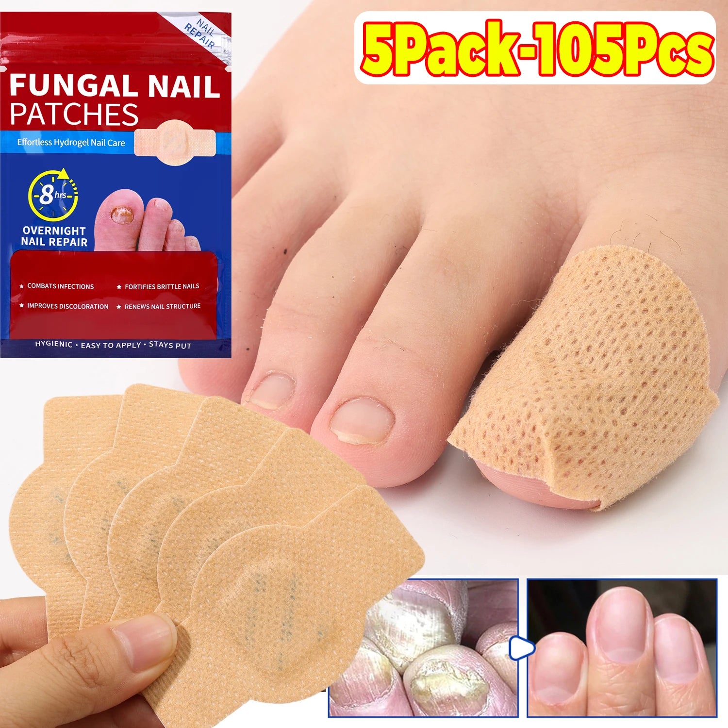 21/210pcs Waterproof Nail Protector Guard, Breathable Finger Sleeve for Weak or Damaged Nails, Reusable Toe Cap Cover