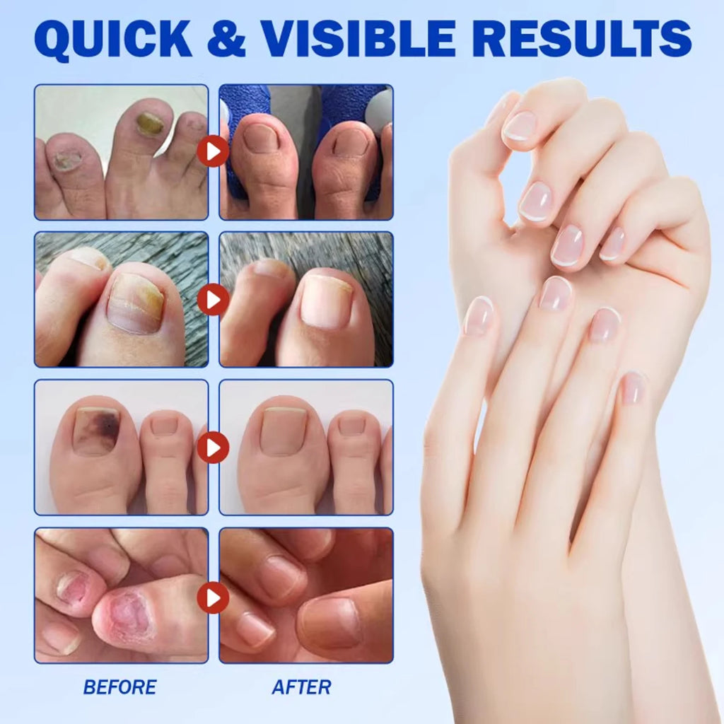21/210pcs Waterproof Nail Protector Guard, Breathable Finger Sleeve for Weak or Damaged Nails, Reusable Toe Cap Cover