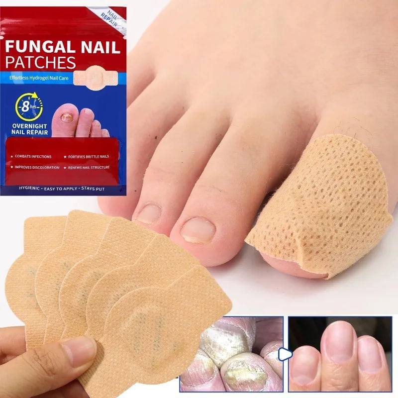 21/210pcs Waterproof Nail Protector Guard, Breathable Finger Sleeve for Weak or Damaged Nails, Reusable Toe Cap Cover
