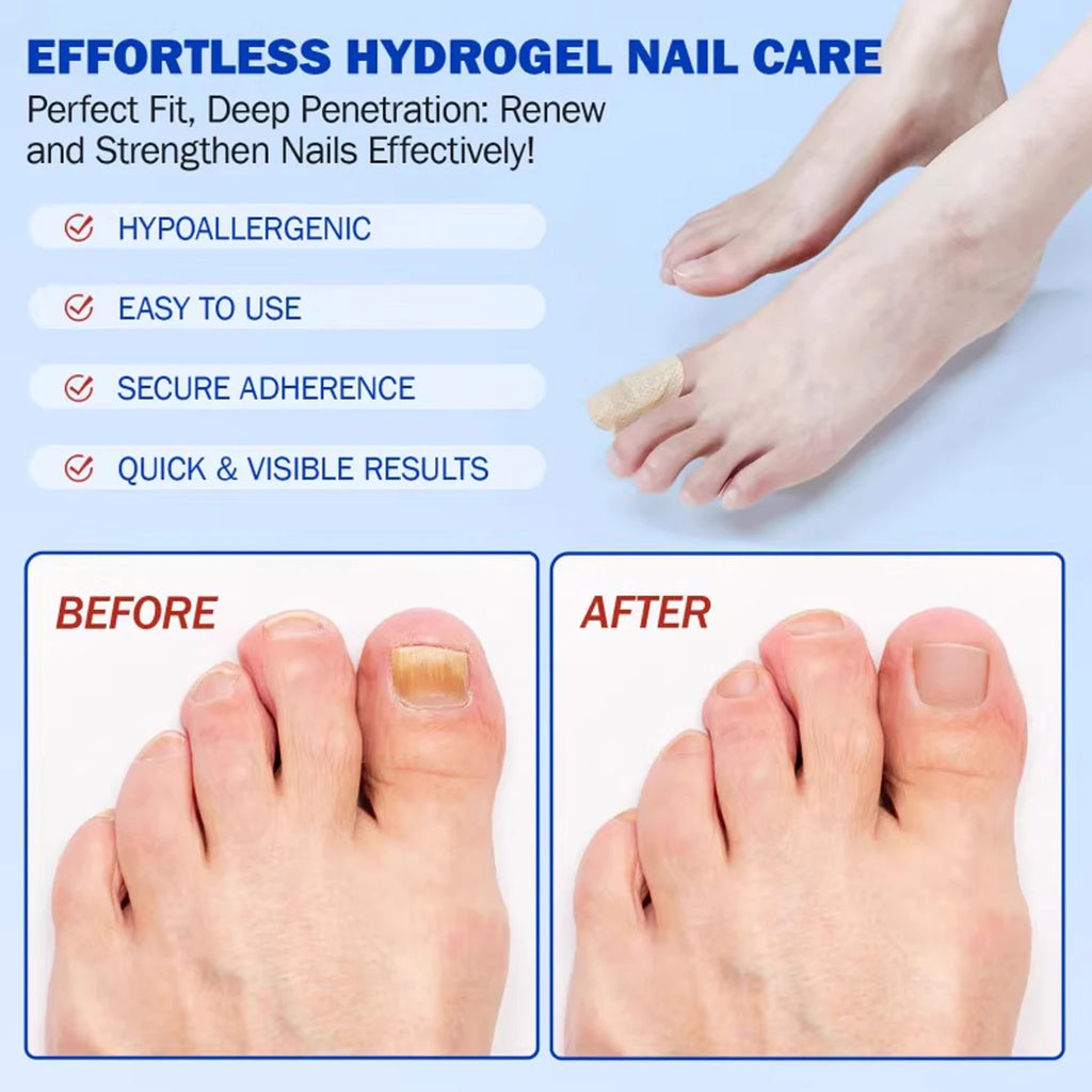 21/210pcs Waterproof Nail Protector Guard, Breathable Finger Sleeve for Weak or Damaged Nails, Reusable Toe Cap Cover