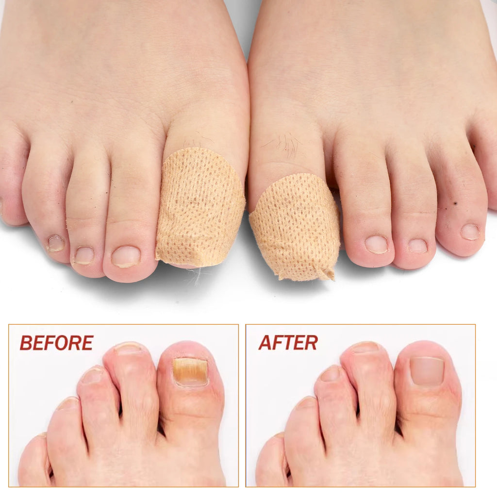 21/210pcs Waterproof Nail Protector Guard, Breathable Finger Sleeve for Weak or Damaged Nails, Reusable Toe Cap Cover