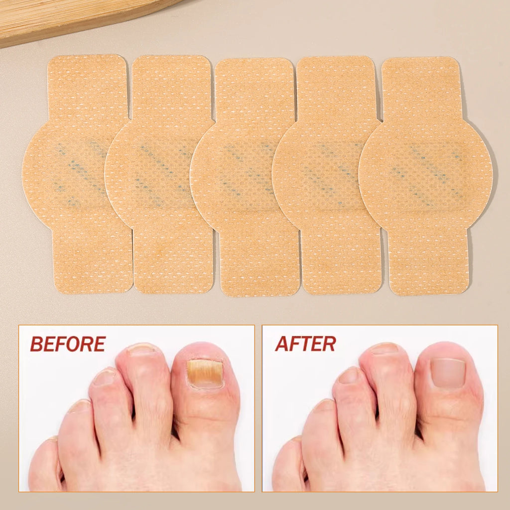 21/210pcs Waterproof Nail Protector Guard, Breathable Finger Sleeve for Weak or Damaged Nails, Reusable Toe Cap Cover